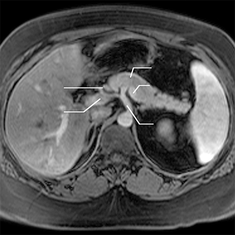 Index of /dept/radiology/radiologysite/images/Med students 7, pancreas